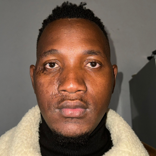 Phumlane Dlamini